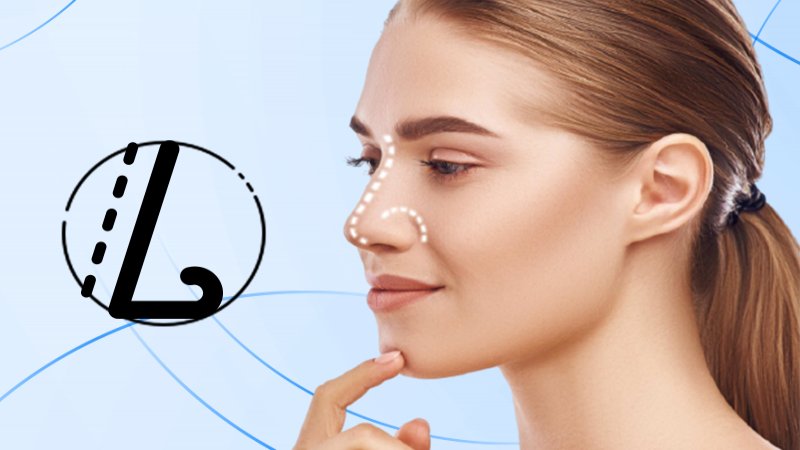 Neuscorrectie  Rhinoplasty