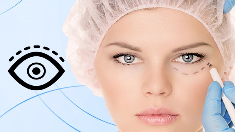 Eyelid Surgery Blepharoplasty